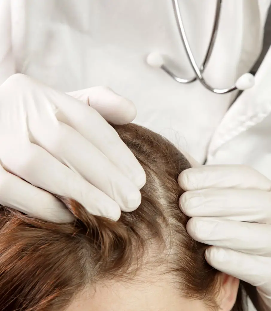 Análisis alopecia